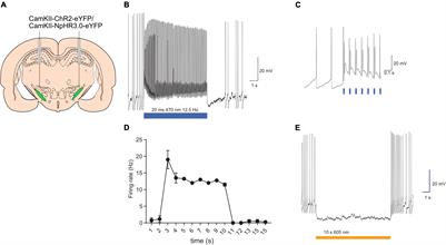 Bidirectional Optogenetic Modulation of the Subthalamic Nucleus in a Rodent Model of Parkinson’s Disease